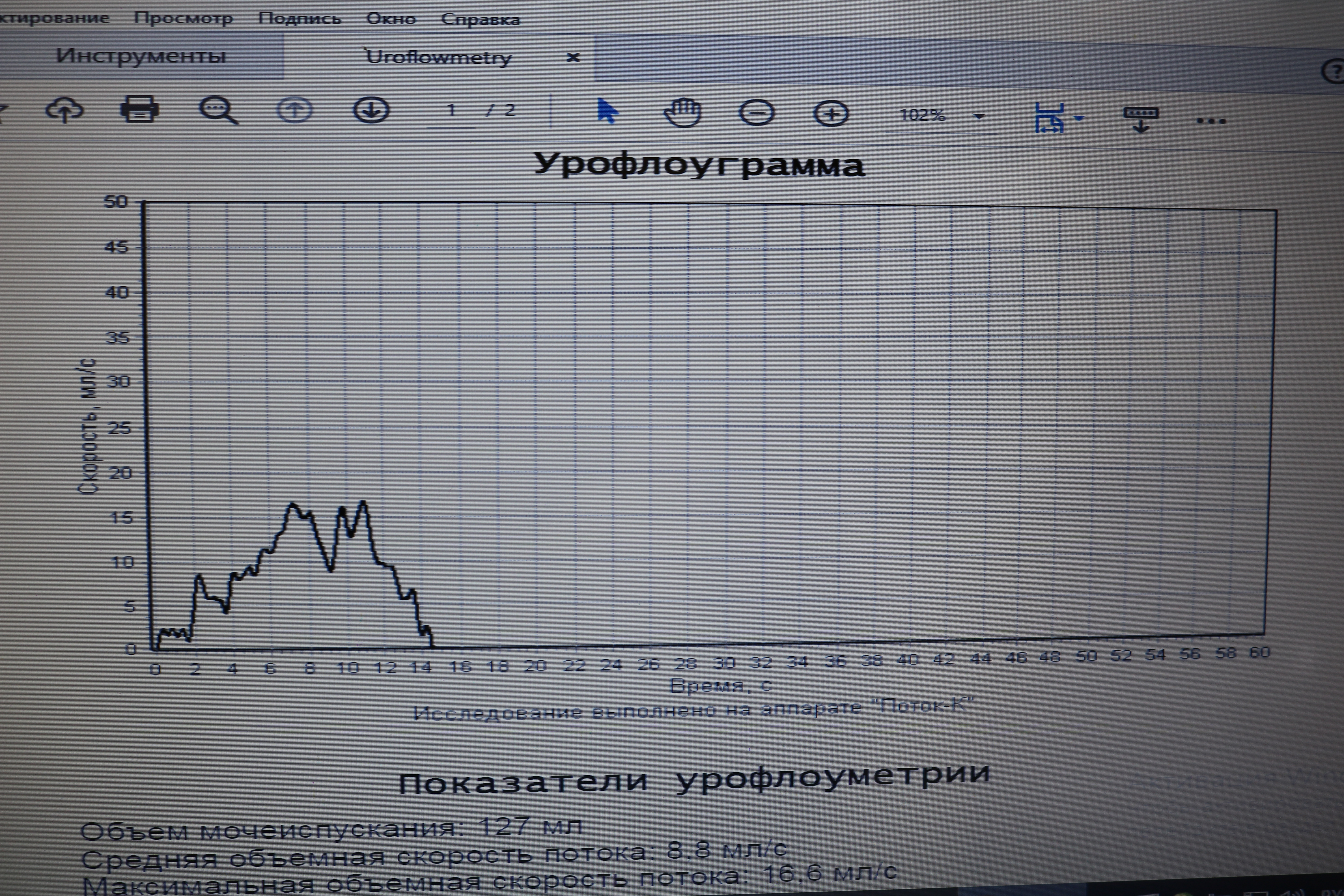 Симптомы хронического цистита